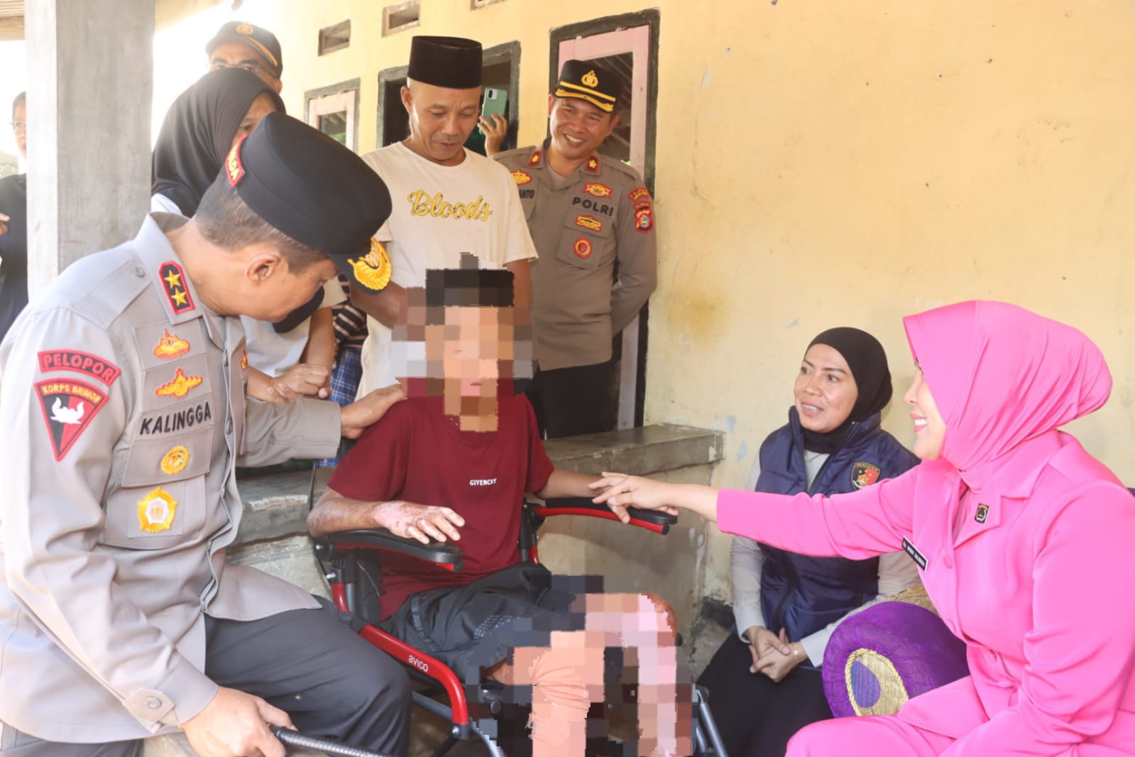 Kapolda NTB Pastikan Penanganan Kasus Santri Korban Kekerasan Dipercepat, Restitusi Korban Dikawal.